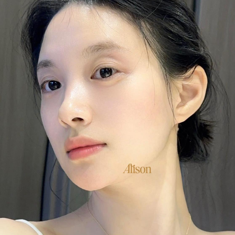Neova Night Therapy Correction